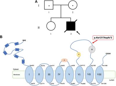 Menkes disease complicated by concurrent ACY1 deficiency: A case report